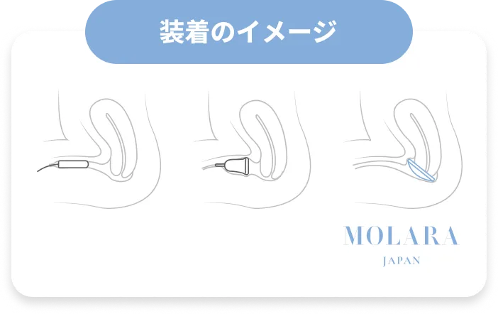 装着のイメージ